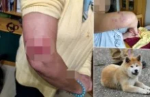 Pies sąsiadki zaatakował i pogryzł kobietę przed jej własnym domem