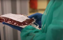 Jakość życia pacjentów po przeszczepie komórek krwiotwórczych.