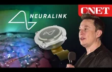 Elon Musk’s Neuralink Event: Everything Revealed in 10 Minutes