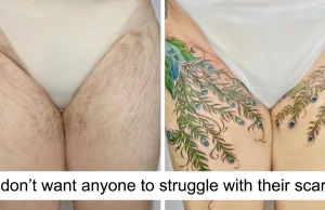 50 razy ludzie prosili o zakrycie swoich blizn, a ten artysta tatuażu to zrobił