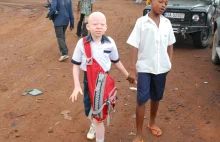 Biali czarni. Rzeź afrykańskich albinosów.