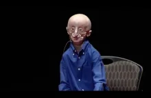 Czym jest szczęśliwe życie wg. osoby chorej.na progerie [ENG] | TEDxMidAtlantic
