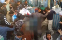 Afganistan: mężczyzna oblewa kwasem 3 dziewczyny za chodzenie do szkoły