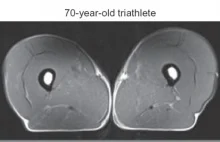 Tak wygląda porównanie nóg 74-letniego triatlonisty, oraz osoby nieaktywnej fizy
