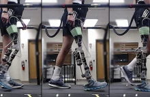 Robotyczna proteza sterowana AI przełomem w chodzeniu po amputacji - NeeWS
