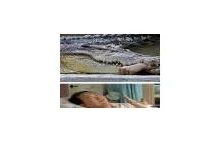 Krokodyl w zoo "odgryzł" ręke weterynarzowi