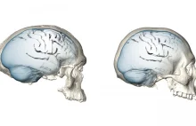 Kształt naszego mózgu jest efektem zupełnie niedawnej ewolucji