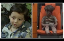 Father of Aleppo boy reveals truth behind image of 'Boy in the Ambulance'
