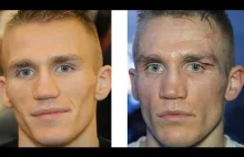 Jak wyglądają twarze pięściarzy przed i po walce