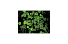 "Naegleria fowleri" - ameba żywiąca się ludzkim mózgiem