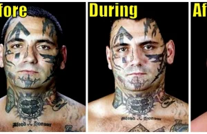 Po 25 zabiegach, przywódca gangu białych "uwolnił" się od tatuaży