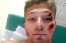 Alex Koliadych, sportowiec z Gorzowa potrącony na pasach w Inowrocławiu. FILM