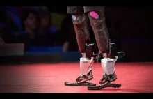 Bioniczne protezy nowej generacji.