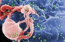 Rząd USA przyznaje: HIV rozwija się głównie w społeczności homoseksualistów