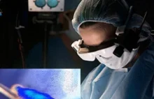 Wizualizacja komórek rakowych - czyli Google Glass dla chirurgów