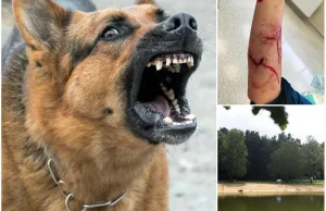 Na policję zgłosiła się właścicielka psów, które pogryzły biegacza.