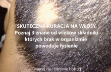 Trzy znane od wieków składniki, których brak w organizmie powoduje łysienie