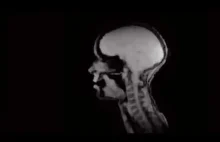 Przekrój głowy podczas śpiewu nagrany na rezonansie magnetycznym