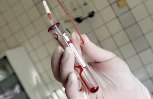 Rosja odpowiada za 2/3 nowych infekcji wirusa HIV w Europie