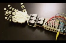 High School Student Creates a Robotic Hand