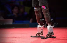 Krótki wykład o protezach bionicznych