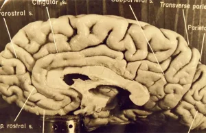 Niezwykłe perypetie mózgu Einsteina
