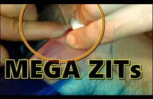 What's that on your ear ??? OMG! This HUGE MEGA ZIT ! (Top 3 HD Video for...