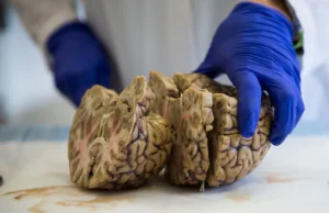 Naukowcy apelują: Potrzebujemy waszych mózgów