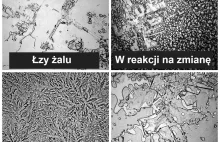 Łzy pod mikroskopem (inaczej wyglądają łzy radości, a inaczej smutku)