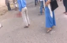 Nieudany zamach samobójczy.