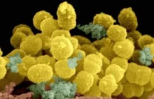 Mikroby, które żywią się uranem.