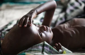 Katastrofa humanitarna w Somalii. Setki tysięcy dzieci cierpią głód.