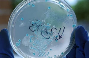 Epidemia E. coli - bakteria z Afryki Środkowej?