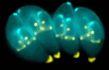 Pasożyt T. gondii powiązany z chorobami: Alzheimera, Parkinsona oraz nowotworami