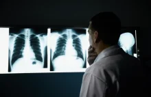 Pierwszy rentgen oparty o sztuczną inteligencję wchodzi oficjal. do użycia w USA