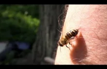 Co się dzieje kiedy ugryzie Cię pszczoła