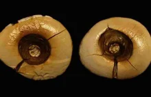 Zabiegi stomatologiczne z epoki lodowcowej