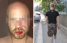 Antifa pobiła mężczyznę ponieważ uznała, że ubiera się jak nazista