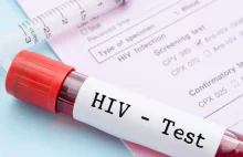 Test na HIV: w trosce o siebie i partnera