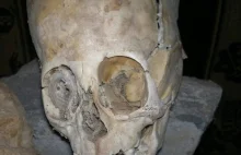 Starożytne czaszki kosmitów z Peru