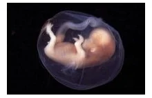 "Aborcja" po urodzeniu? Szokujący pomysł włoskich bioetyków.