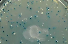 O tym, jak zmienić bakterie jelitowe w detektory związków chemicznych