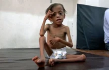 Jemen. Miliony ludzi mogą umrzeć z głodu