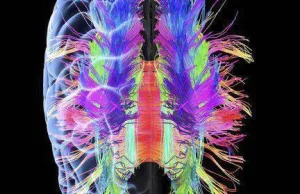 Neuroseksizm uczonych, czyli draka o płeć mózgu