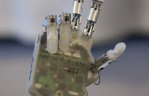 Bioniczna dłoń dzięki której ludzie po amputacji znów mogą poczuć dotyk.