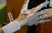 Rapael Smart Glove: rękawica, która leczy za pomocą gier osoby po udarze mózgu