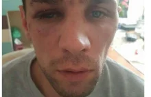 UK. Polak został zaatakowany przez Brytyjczyka w pracy. Policja nie reaguje