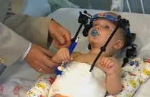 Lekarze uratowali niemowlę po... wewnętrznej dekapitacji!