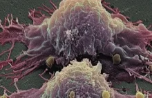 Macierzyste komórki rakowe - jak je dopadniemy, wygramy z rakiem