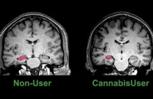 Długi Wpływ marihuany na mózg [US]